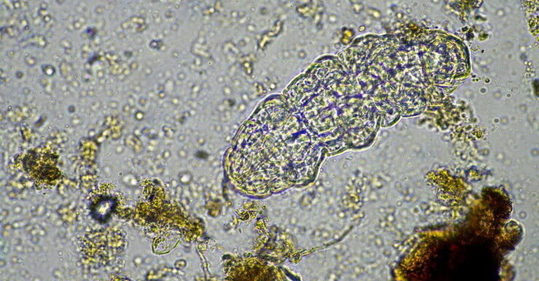 Fungal Pathogens MCQs