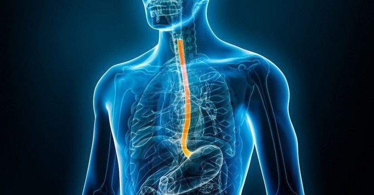 Esophagus MCQs