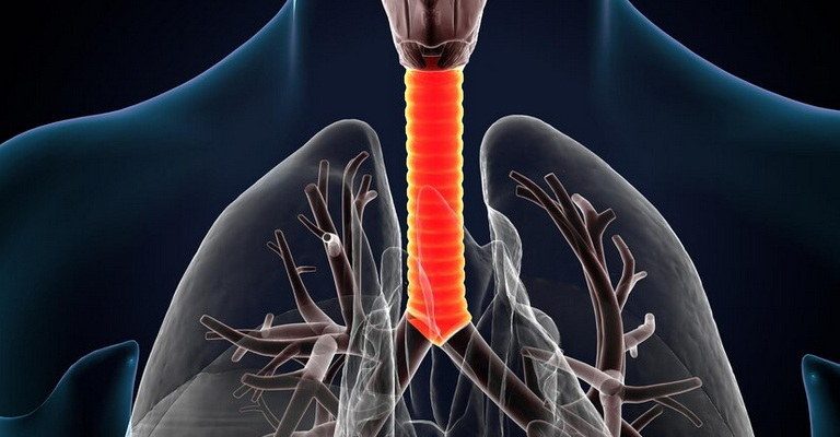 Lower Respiratory Tract MCQs