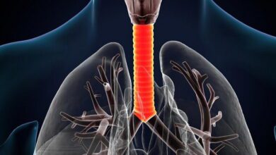 Lower Respiratory Tract MCQs